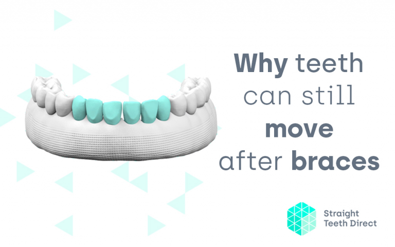 Why Teeth Move
