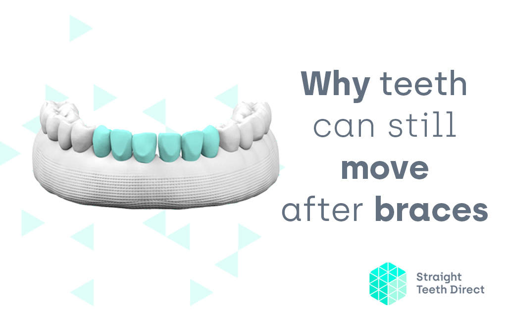 Why Teeth Move