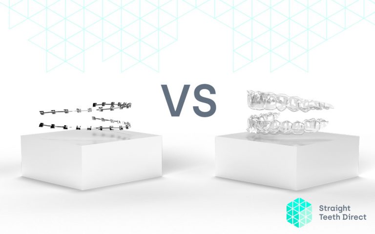 fixed braces vs clear aligners