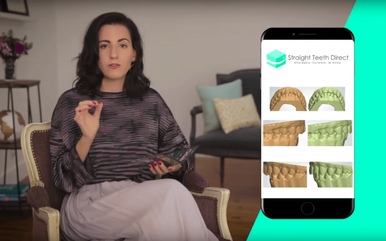 home teeth straightening