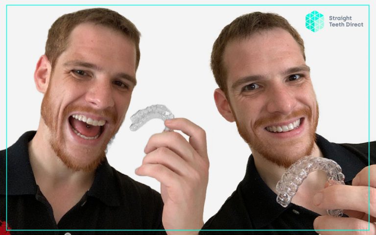 Online teeth straightening for the modern generation - Ben’s testimonial