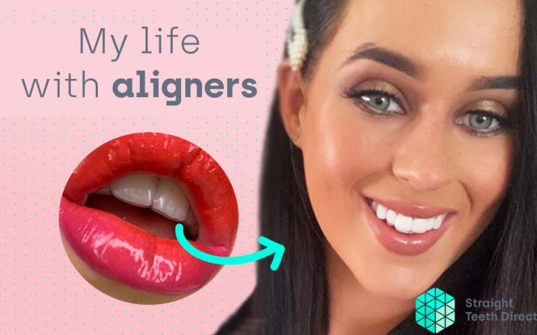 Maisie cover - convenient invisible aligners