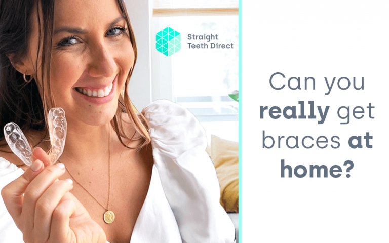 Cosmetic Teeth Straightening With Braces At Home