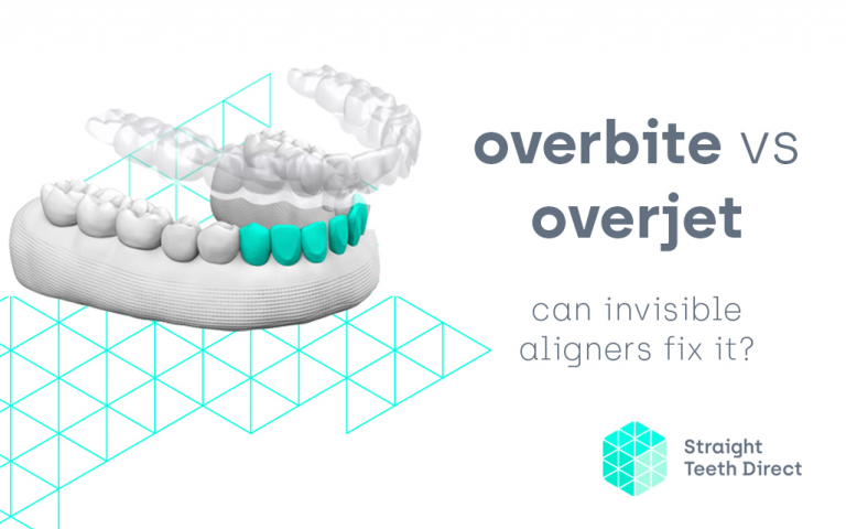 Aligners and overbite vs overjet